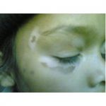 AROGYAM-PURE-HERBS-KIT-FOR-VITILIGO