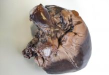 Mimaki’s 3D Printing Techniques Praised By Medical Experts In Latest Project Mimaki’s 3D Printing Techniques Praised By Medical Experts In Latest Project